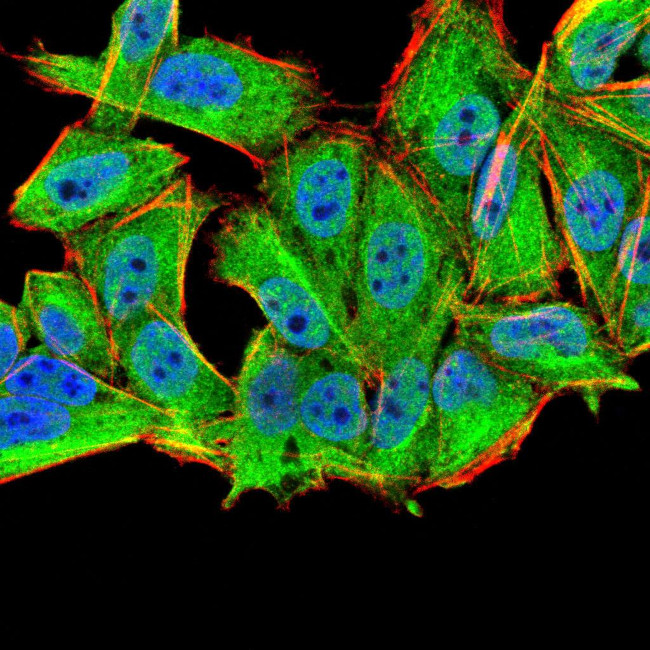 MURF1 Antibody in Immunocytochemistry (ICC/IF)