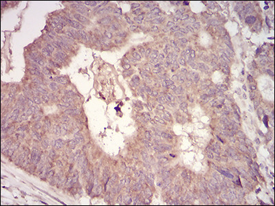 MURF1 Antibody in Immunohistochemistry (Paraffin) (IHC (P))