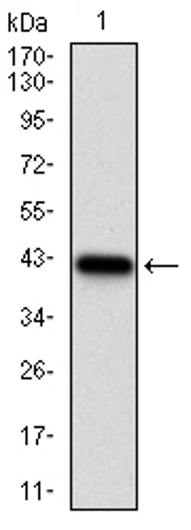 NPC1 Antibody in Western Blot (WB)