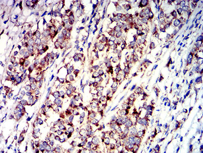 P2Y1 Antibody in Immunohistochemistry (Paraffin) (IHC (P))