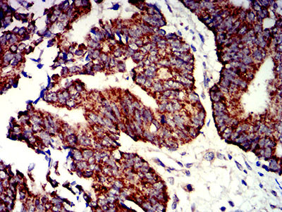 P2Y1 Antibody in Immunohistochemistry (Paraffin) (IHC (P))