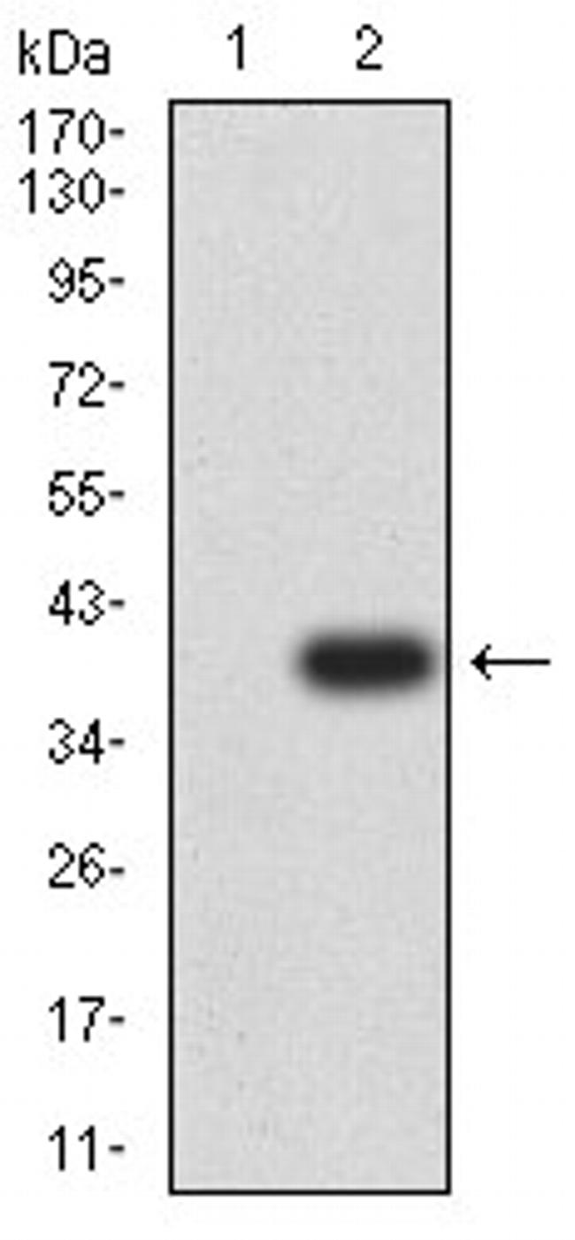 P2Y12 Antibody in Western Blot (WB)