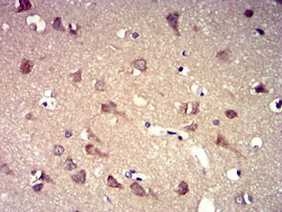 P2Y8 Antibody in Immunohistochemistry (Paraffin) (IHC (P))