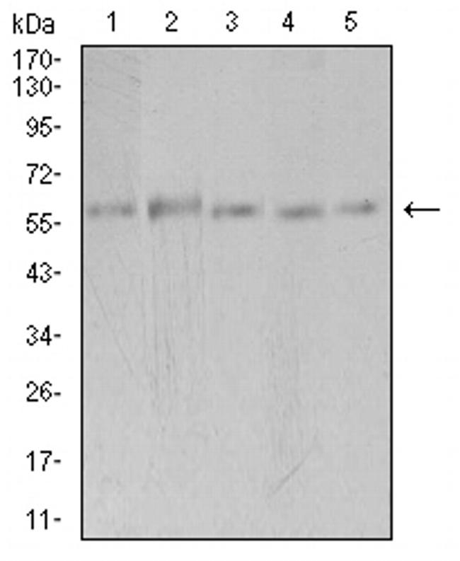 PAK3 Antibody in Western Blot (WB)