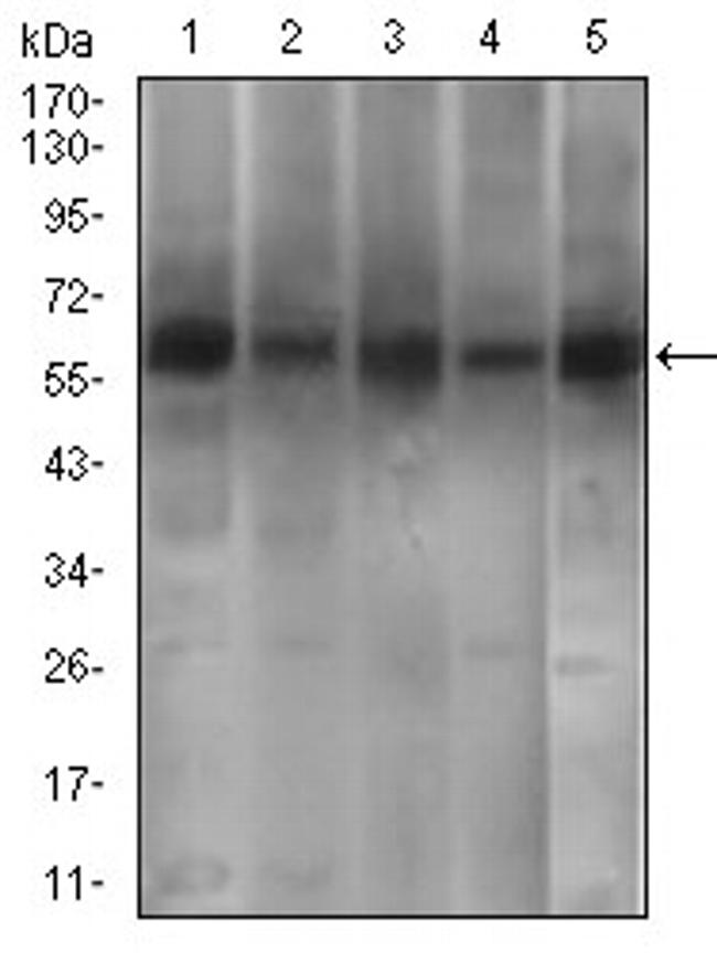 PDE1B Antibody in Western Blot (WB)