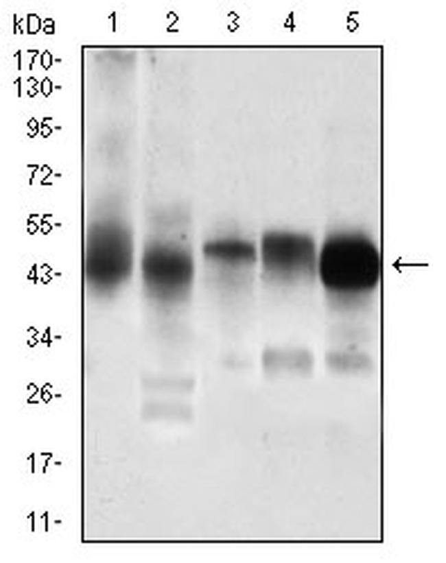 PDK2 Antibody in Western Blot (WB)