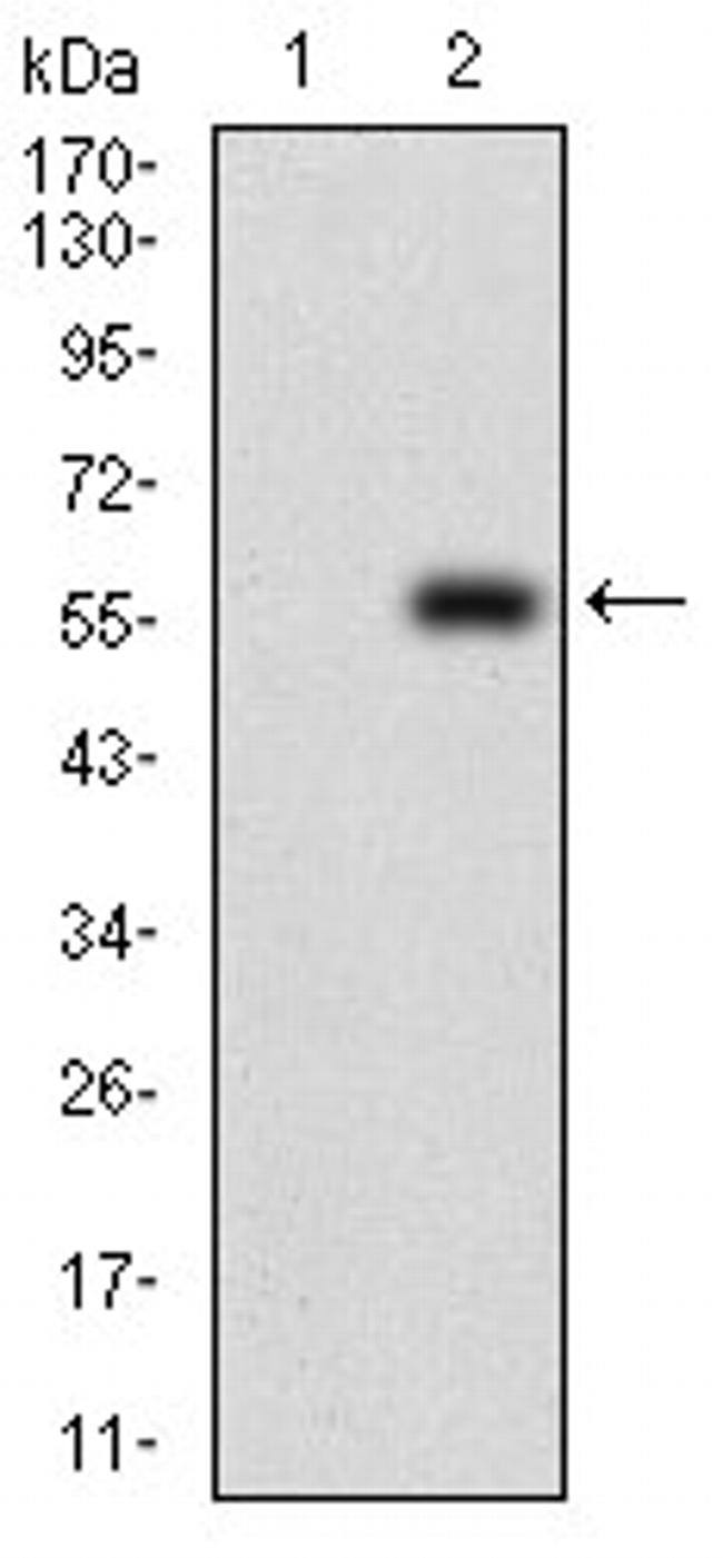 PDK2 Antibody in Western Blot (WB)