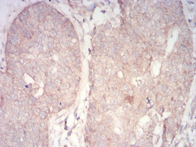 PDPK1 Antibody in Immunohistochemistry (Paraffin) (IHC (P))