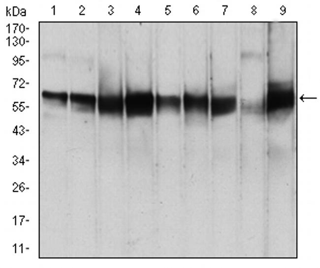 PDPK1 Antibody in Western Blot (WB)