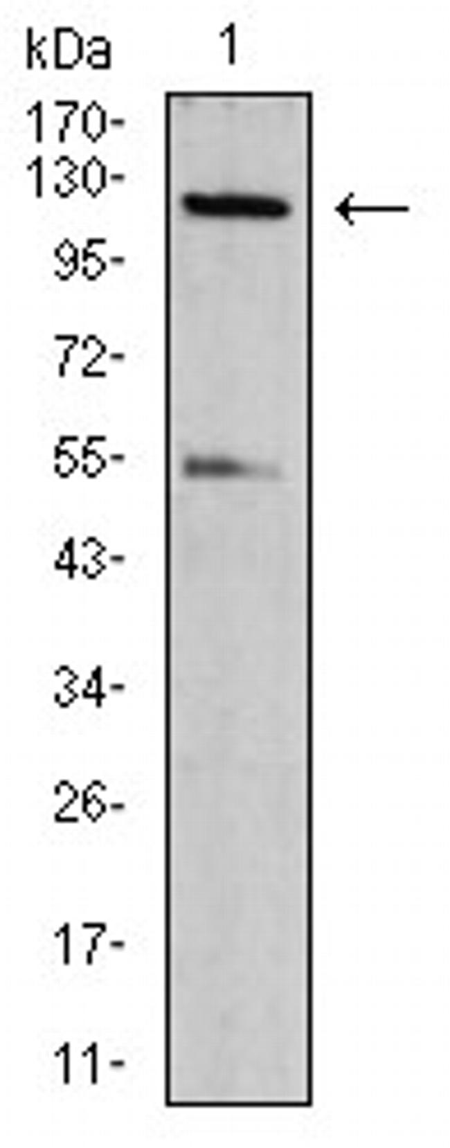 Phospho-NLRC4 (Ser533) Antibody in Western Blot (WB)