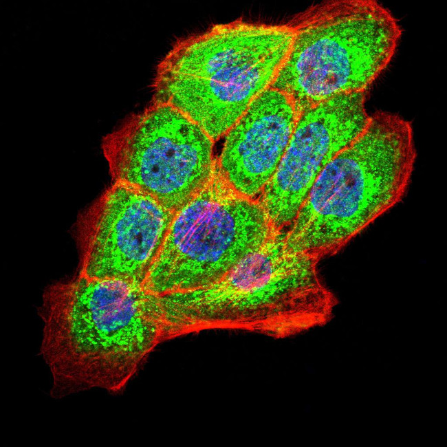 PKHD1 Antibody in Immunocytochemistry (ICC/IF)