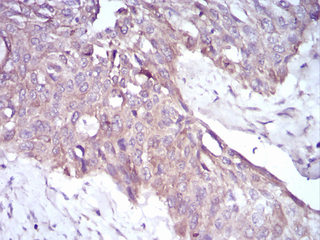 PKHD1 Antibody in Immunohistochemistry (Paraffin) (IHC (P))