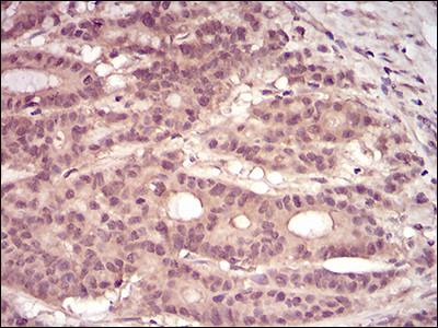 PKN1 Antibody in Immunohistochemistry (Paraffin) (IHC (P))