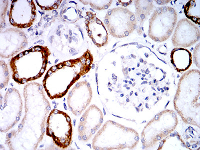 PLD2 Antibody in Immunohistochemistry (Paraffin) (IHC (P))