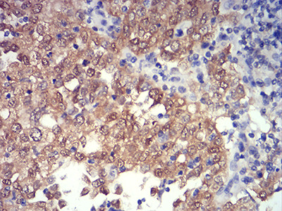 PRDM4 Antibody in Immunohistochemistry (Paraffin) (IHC (P))