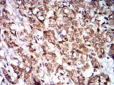 PTPN14 Antibody in Immunohistochemistry (Paraffin) (IHC (P))