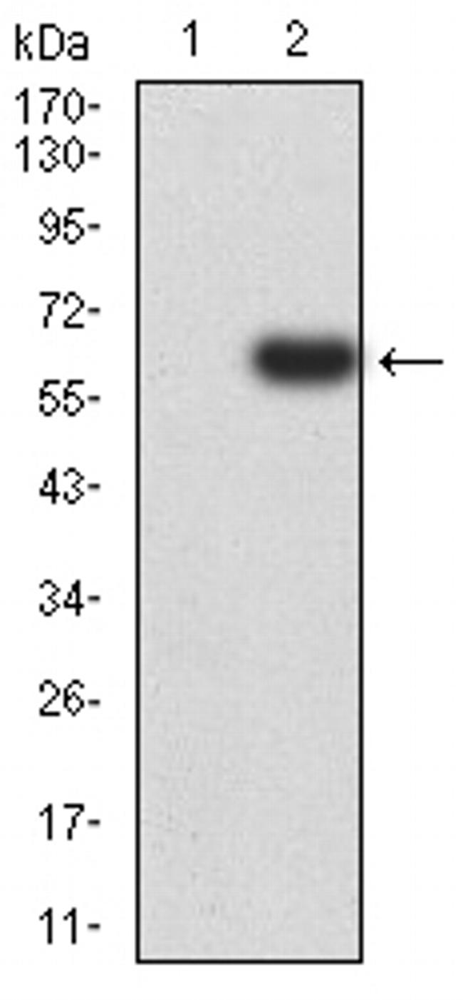 PTPN14 Antibody in Western Blot (WB)