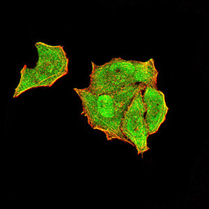 PTPN14 Antibody in Immunocytochemistry (ICC/IF)