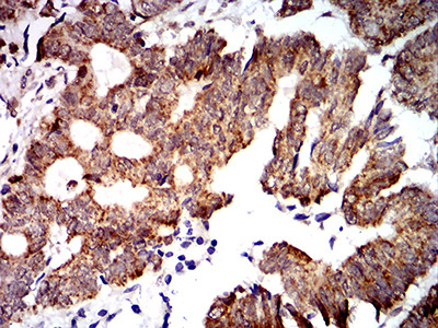 PTPN14 Antibody in Immunohistochemistry (Paraffin) (IHC (P))