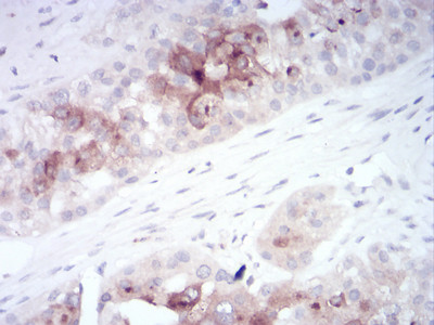 RAB11FIP1 Antibody in Immunohistochemistry (Paraffin) (IHC (P))