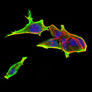 RAB13 Antibody in Immunocytochemistry (ICC/IF)