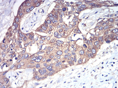 RAB1B Antibody in Immunohistochemistry (Paraffin) (IHC (P))