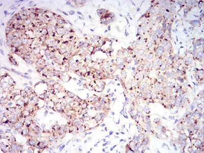 RAB6B Antibody in Immunohistochemistry (Paraffin) (IHC (P))