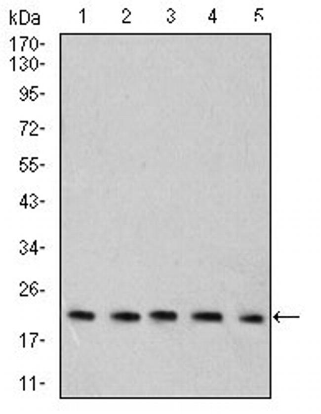 RAB6B Antibody in Western Blot (WB)