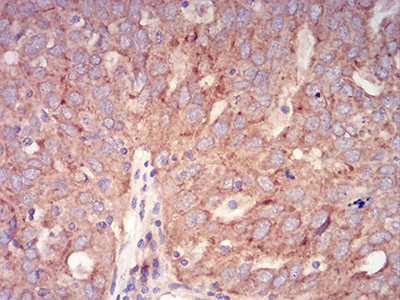 RAB6B Antibody in Immunohistochemistry (Paraffin) (IHC (P))