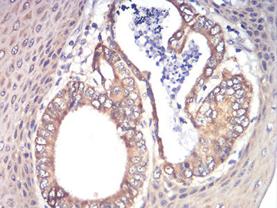 RAD21 Antibody in Immunohistochemistry (Paraffin) (IHC (P))