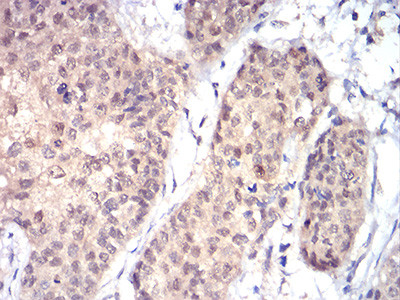 RAD23A Antibody in Immunohistochemistry (Paraffin) (IHC (P))