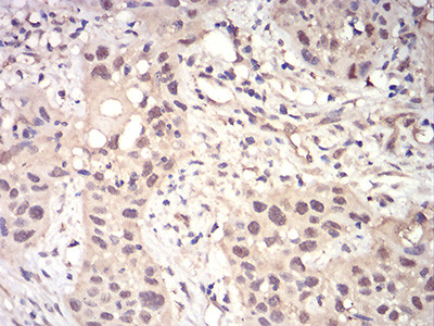 RAD23A Antibody in Immunohistochemistry (Paraffin) (IHC (P))