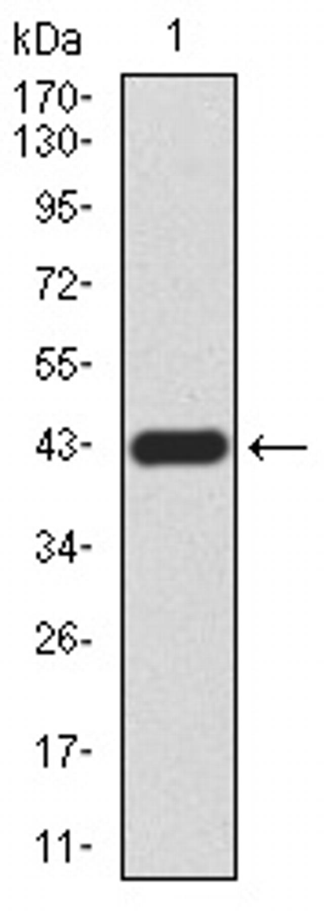 RAD52 Antibody in Western Blot (WB)