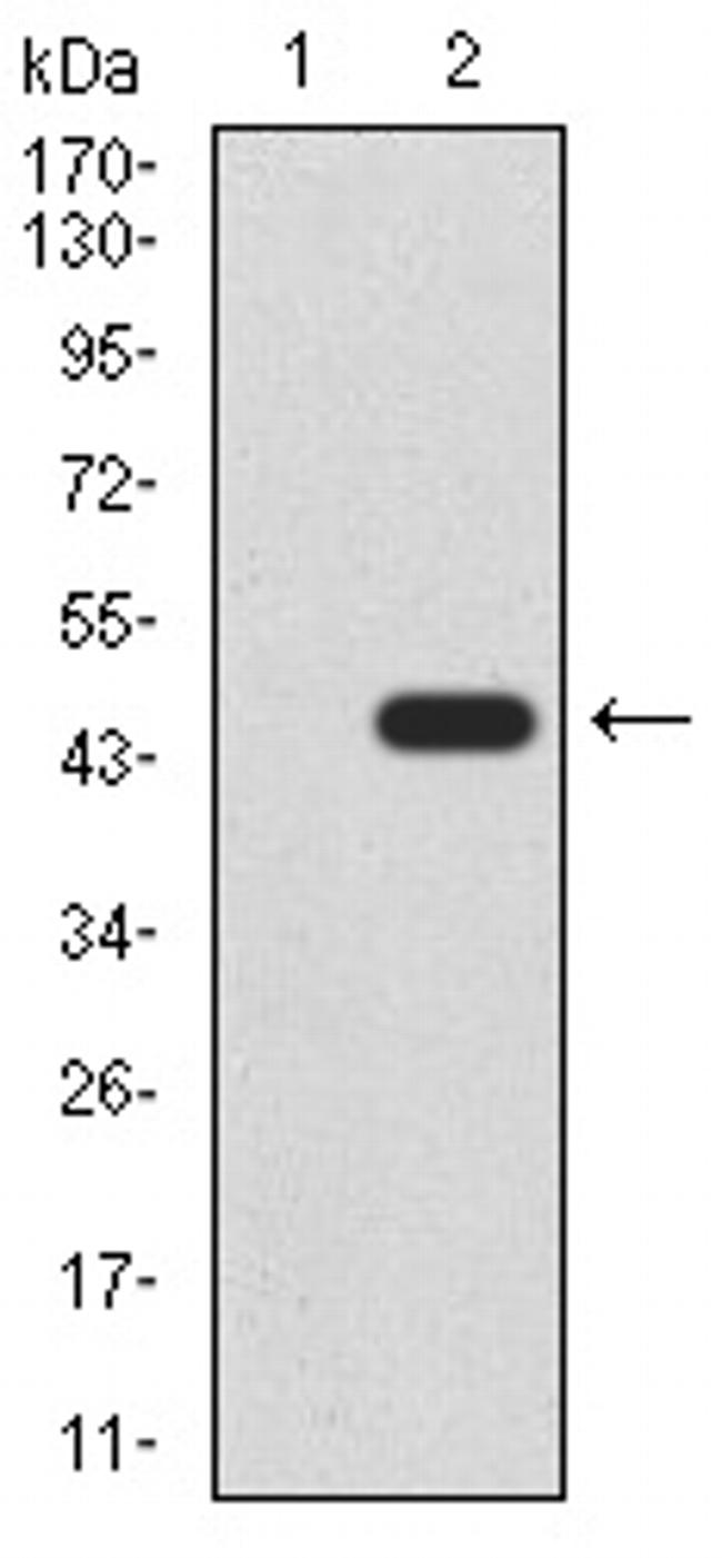 RAD52 Antibody in Western Blot (WB)