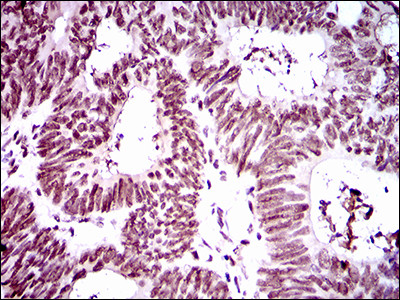 RING1 Antibody in Immunohistochemistry (Paraffin) (IHC (P))