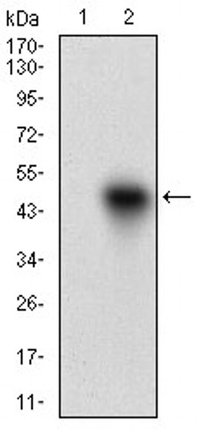 ROR2 Antibody in Western Blot (WB)