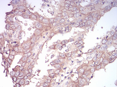 SPHK2 Antibody in Immunohistochemistry (Paraffin) (IHC (P))