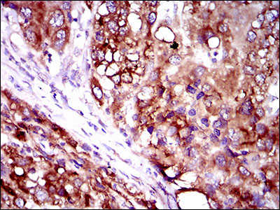 SLC27A2 Antibody in Immunohistochemistry (Paraffin) (IHC (P))