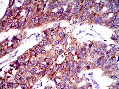 SLC27A2 Antibody in Immunohistochemistry (Paraffin) (IHC (P))