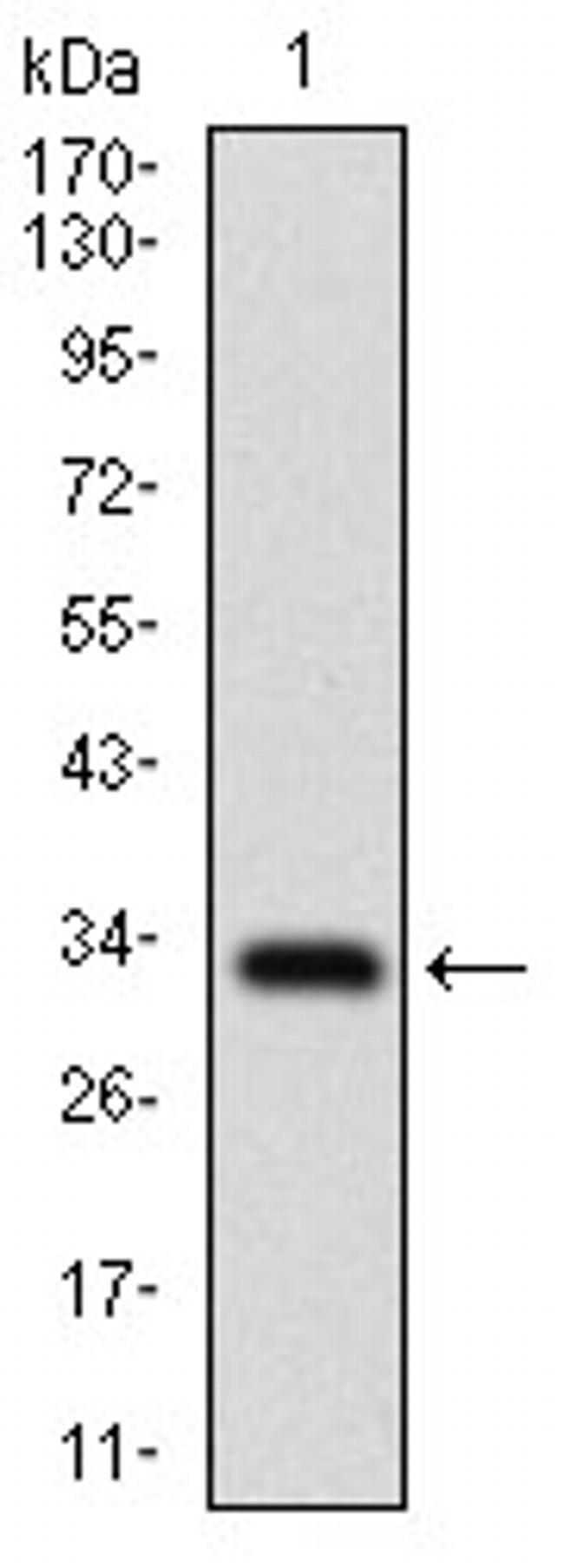 SLC27A2 Antibody in Western Blot (WB)