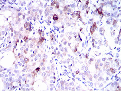 SLC27A5 Antibody in Immunohistochemistry (Paraffin) (IHC (P))