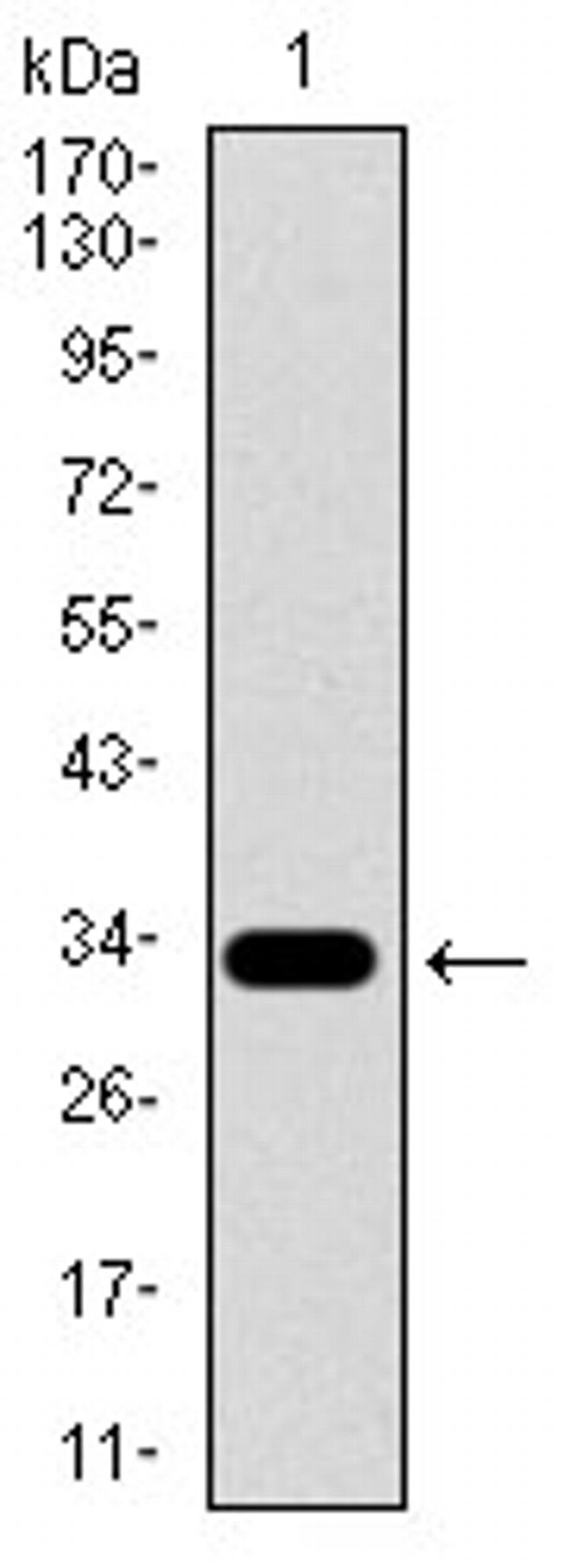 SLC27A5 Antibody in Western Blot (WB)