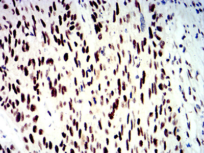 SMARCA1 Antibody in Immunohistochemistry (Paraffin) (IHC (P))