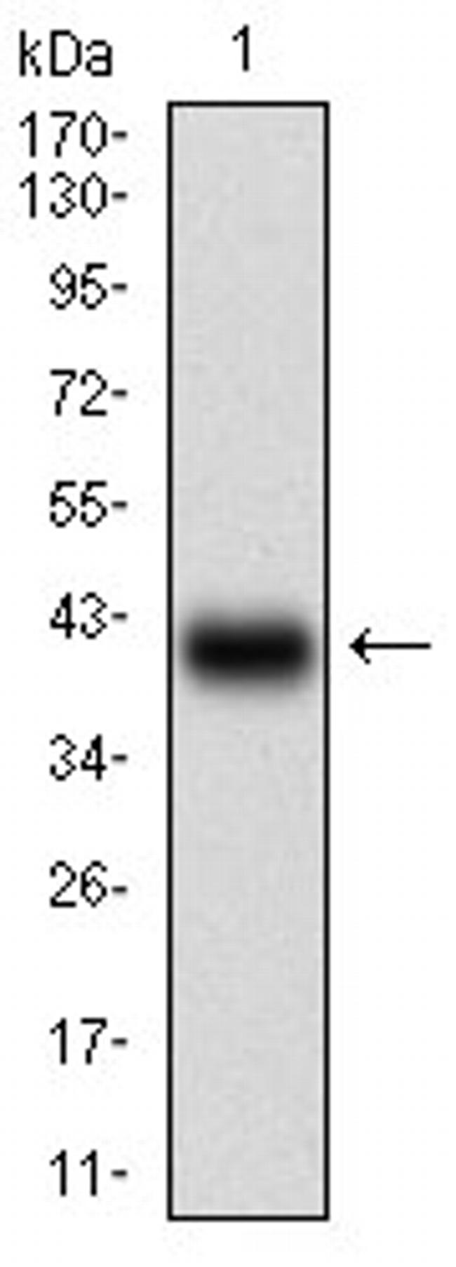 SSTR3 Antibody in Western Blot (WB)