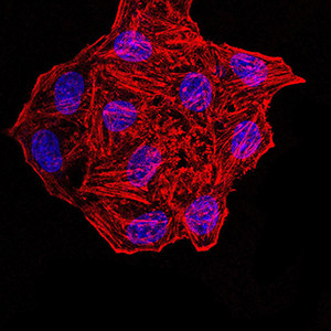 Synapsin 1 Antibody in Immunocytochemistry (ICC/IF)