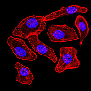 Synapsin 1 Antibody in Immunocytochemistry (ICC/IF)