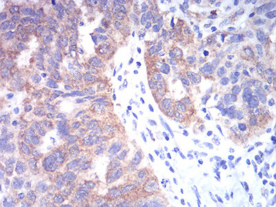 TBCC Antibody in Immunohistochemistry (Paraffin) (IHC (P))