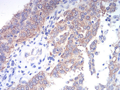 TBCC Antibody in Immunohistochemistry (Paraffin) (IHC (P))