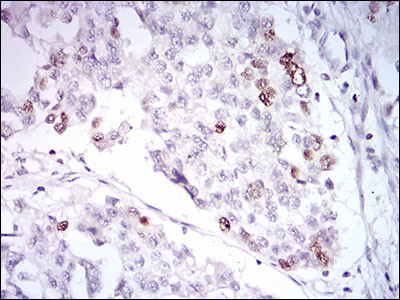 TRF2 Antibody in Immunohistochemistry (Paraffin) (IHC (P))