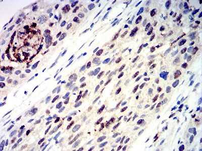 AP2 gamma Antibody in Immunohistochemistry (Paraffin) (IHC (P))